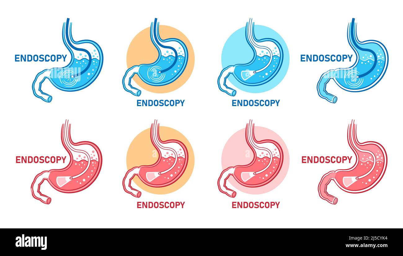 Endoscopia stomaco, gastroscopia, gastrointestinale medico diagnostica icone set. Endoscopio gastroenterologico, esame del tratto gastrointestinale. Vettore Illustrazione Vettoriale