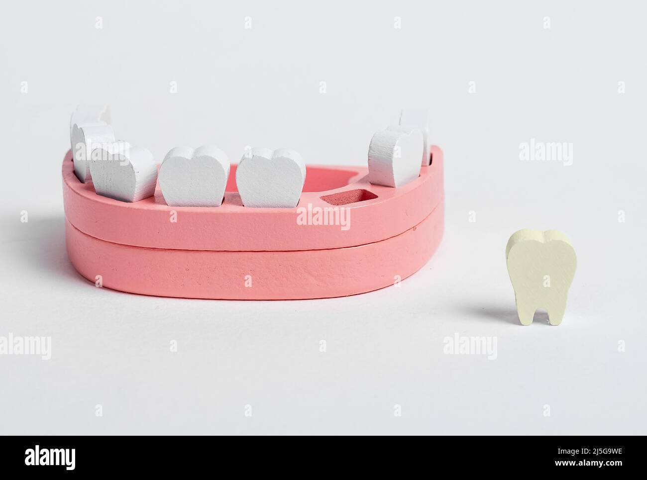 Modello di mandibola di legno e caduto fuori il dente difettoso con la placca, cavità. Malattie