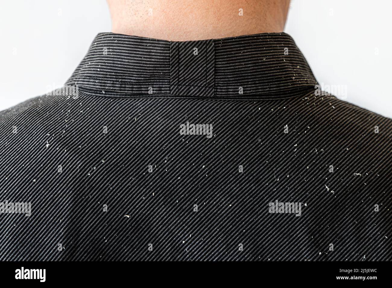 Vista ravvicinata delle spalle della persona in camicia nera ricoperta di forforfora. Spazio di copia. Il concetto di psoriasi e dermatite seborroica. Foto Stock