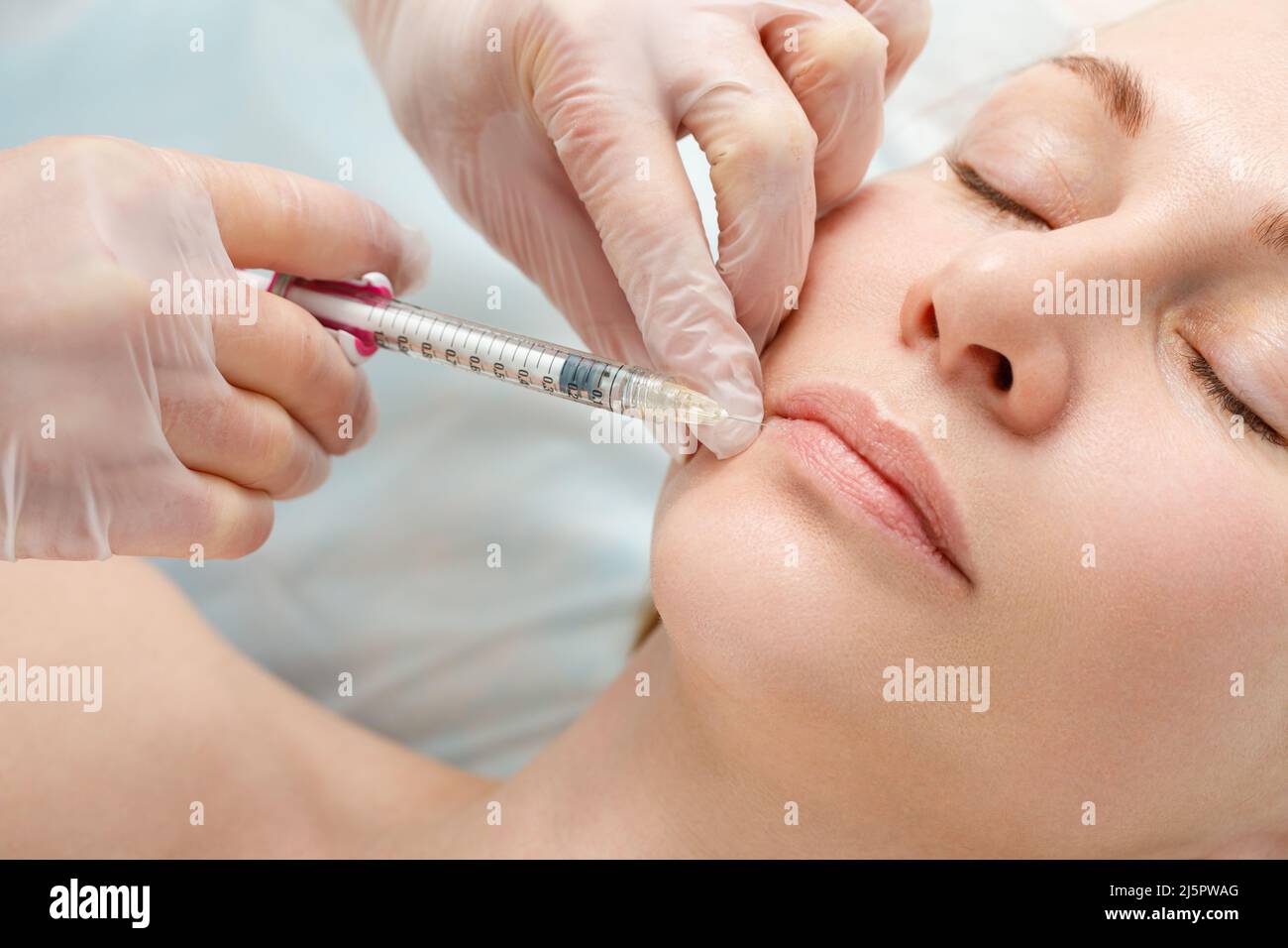 Una donna fa la correzione della forma del labbro in una clinica di cosmetologia. Iniezioni delle labbra, aumento delle labbra. Foto Stock