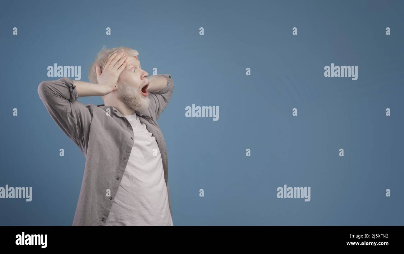 WOW, è incredibile. Ragazzo albino sorpreso vedendo pubblicità scioccante, emotivamente reagendo, panorama, spazio libero Foto Stock