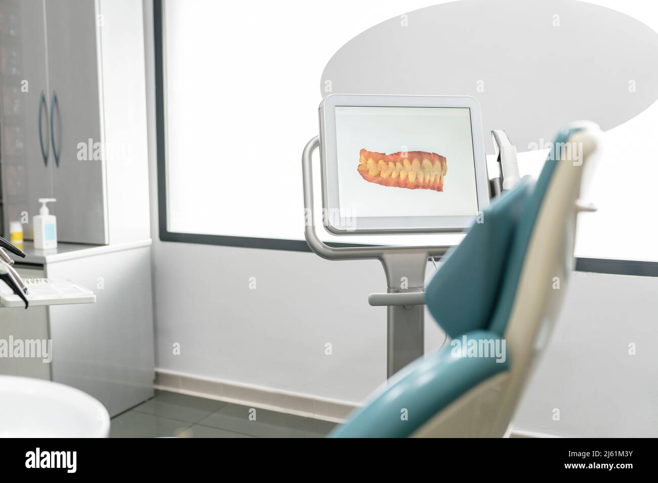 Immagine scansionata dei denti sullo schermo del monitor presso la moderna clinica dentale Foto Stock