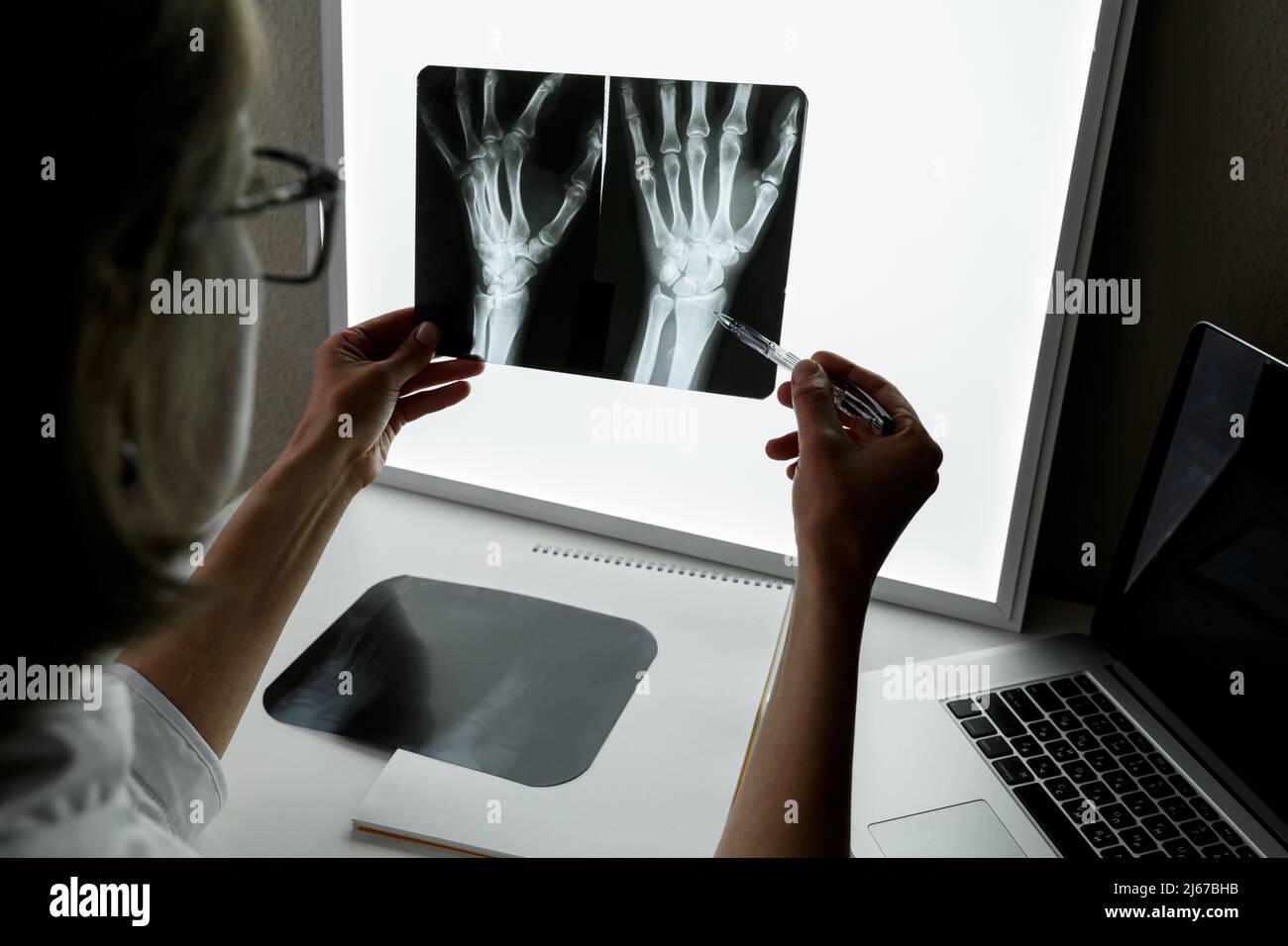 Traumatologo chirurgo che esamina una radiografia del polso traumatizzato. Concetto di assistenza sanitaria e assicurazione medica Foto Stock