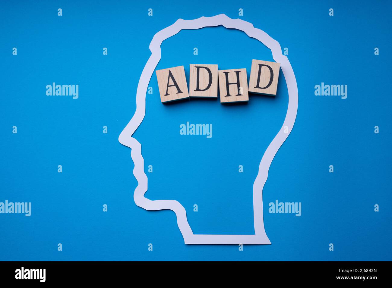 Cervello ADHD. Confusione e depressione degli adulti. Concetto di stress Foto Stock