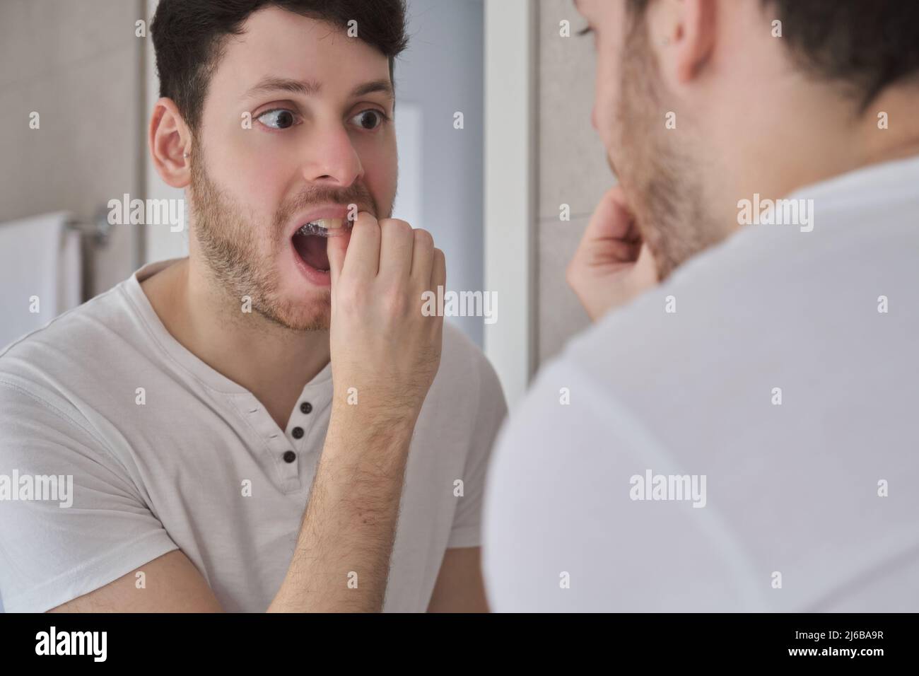 Primo piano del giovane latino rimuovendo invisibili bretelle aligner. Foto Stock