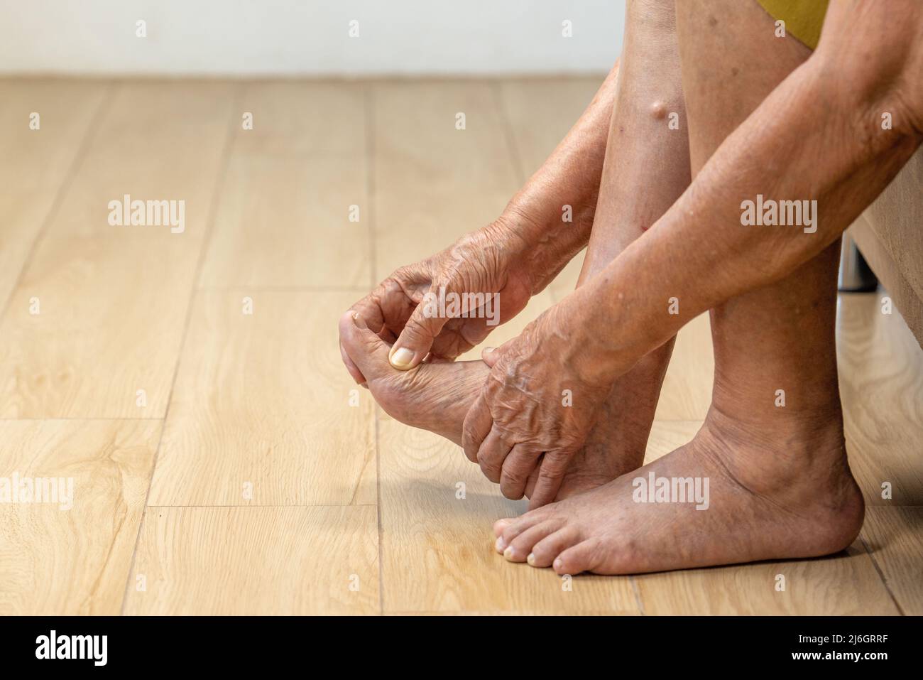 Donna anziana massaggia il piede con dolorosa infiammazione della gotta gonfia Foto Stock