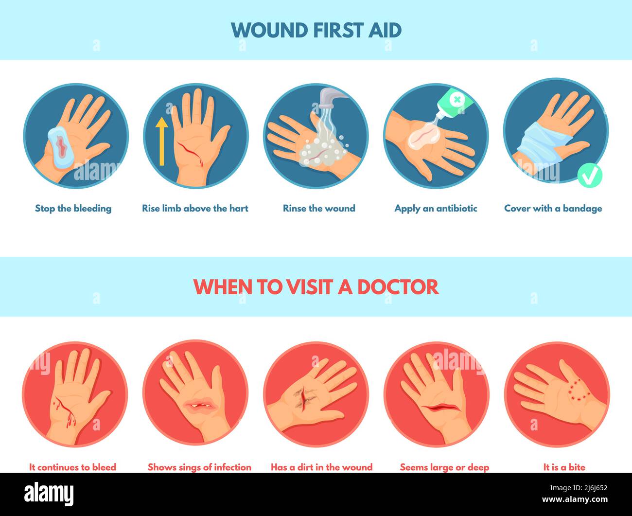 Aiutare la ferita cutanea. I primi aiuti arrestano il sanguinamento, infografica trattamento di emergenza mani danneggiate taglio lesioni infette, passi medicazione medica, dolore lesioni incidente, vettore chiaro illustrazione di assistenza medica Illustrazione Vettoriale