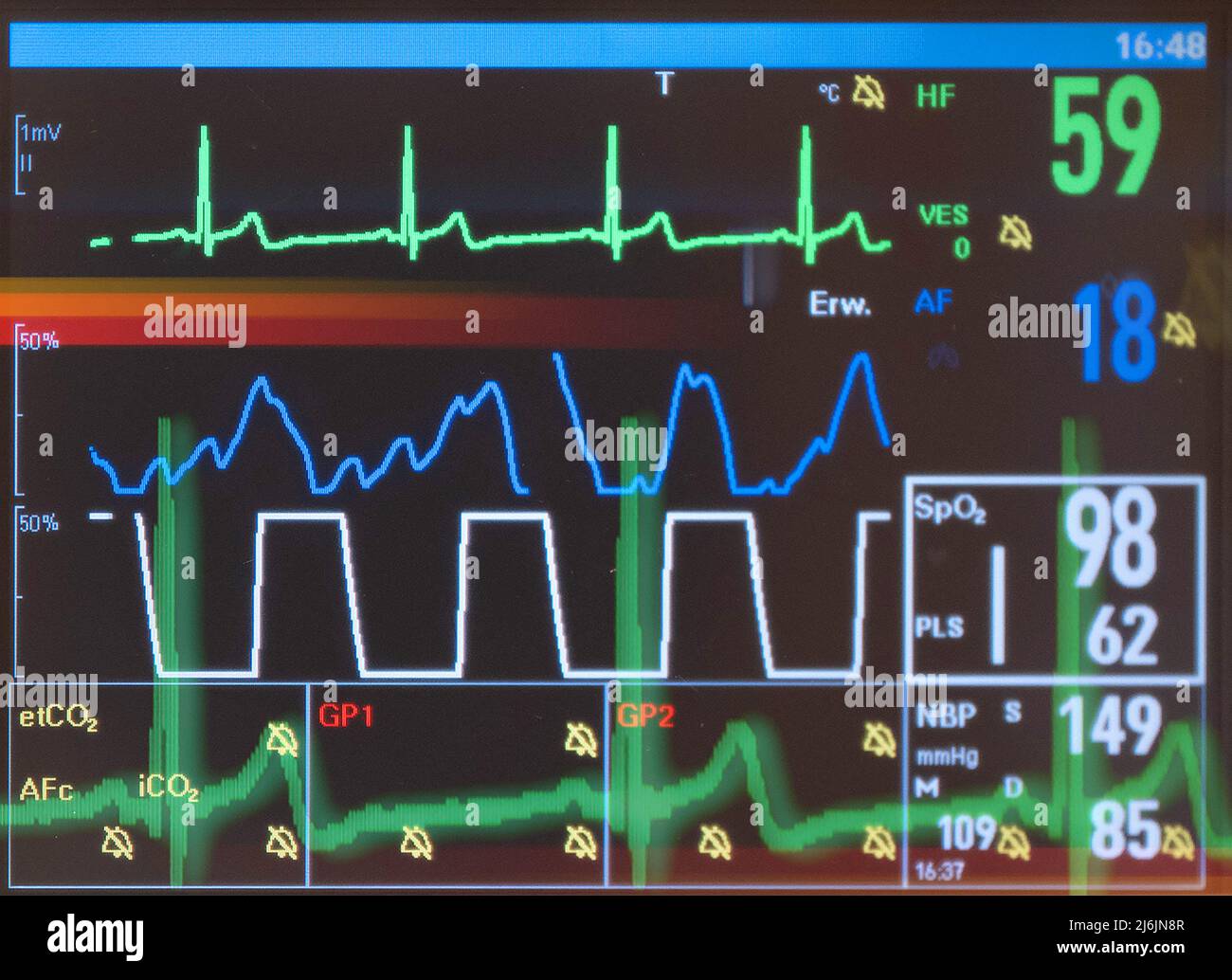 La curva grafica del battito cardiaco umano viene visualizzata da un dispositivo di misurazione. Foto Stock