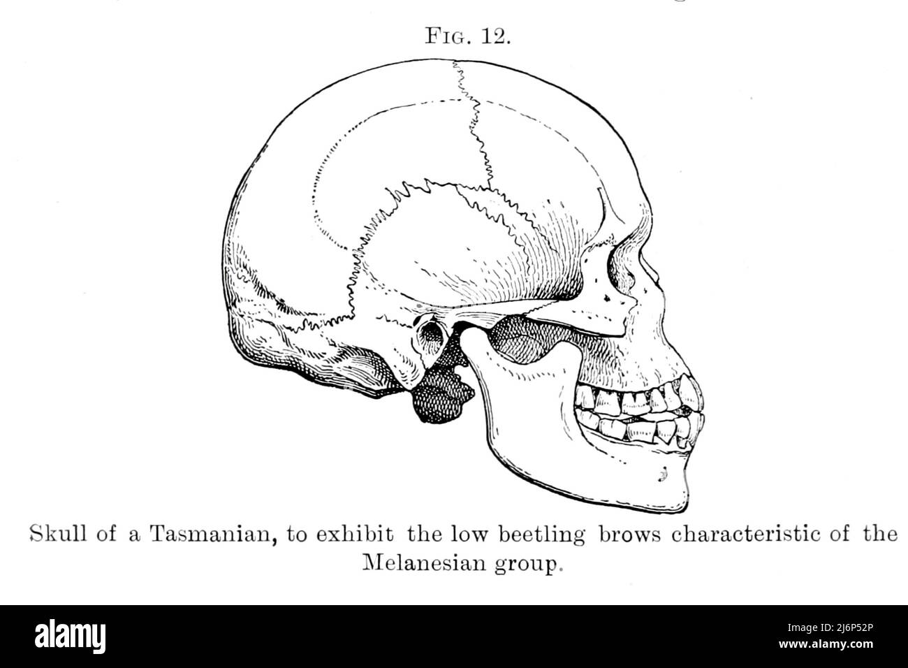 Cranio della Tasmania, per esporre le basse covate di coleotteri caratteristiche del Gruppo Melanesiano dal libro 'Guida agli esemplari che illustrano le razze dell'umanità (antropologia), esposti nel Dipartimento di Zoologia, British Museum (Natural History)' del British Museum (Natural History). Dipartimento di Zoologia; Richard Lydekker, 1849-1915 Data di pubblicazione 1908 Foto Stock