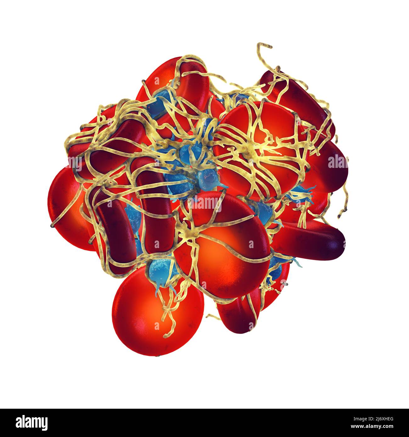 Piastrine attivate (trombociti) che formano un coagulo di sangue (trombo) coperto da mesh di fibrina. Coagulo di sangue isolato su bianco Foto Stock