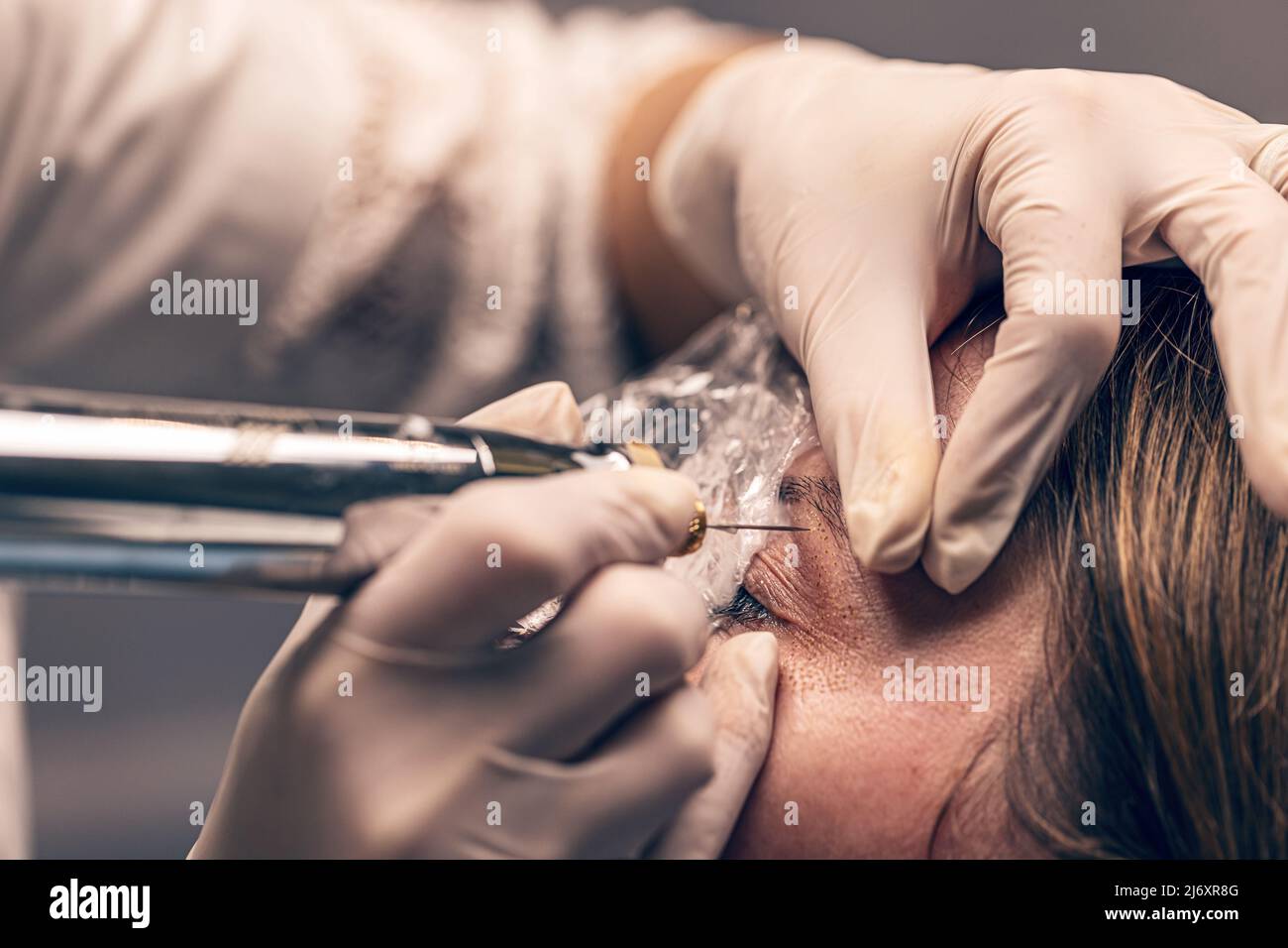 Sollevamento dell'occhio del plasma, trattamento anti-invecchiamento avanzato, comunemente noto come sollevamento della palpebra non chirurgico o blefaroplastica non invasiva Foto Stock