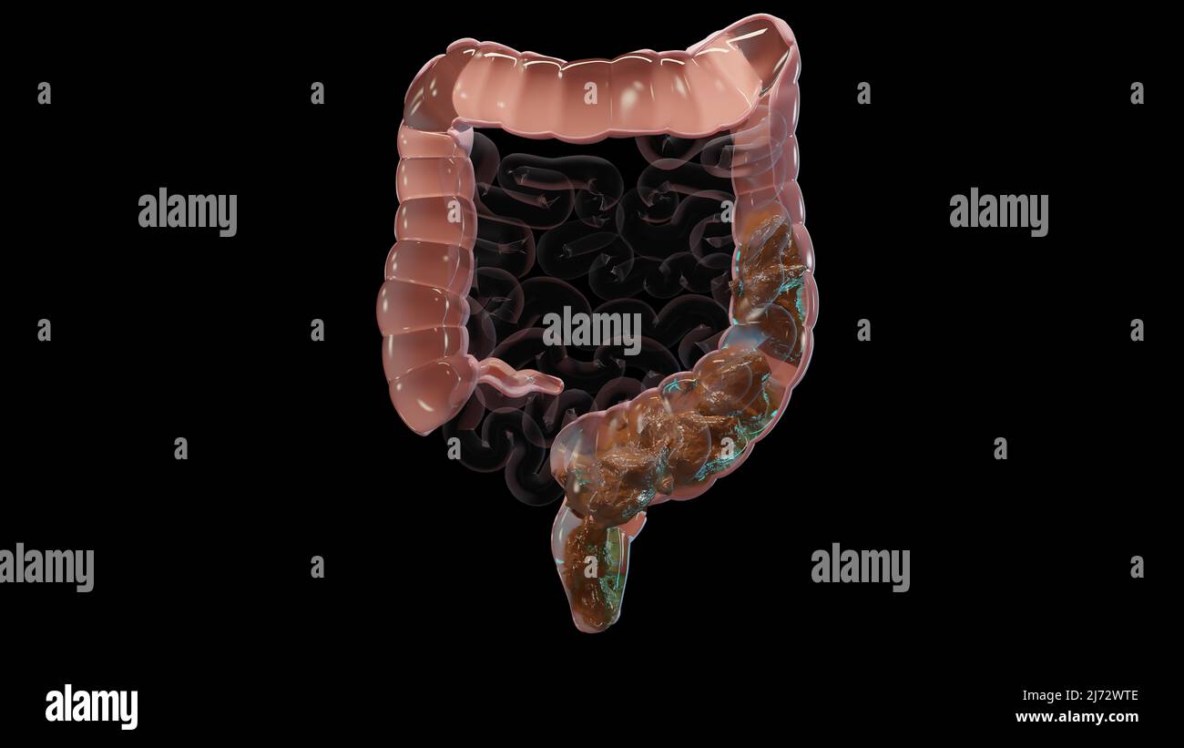 3d illustrazione dell'anatomia umana del sistema digestivo, concetto dell'intestino, lassativo, traitement della costipazione, 3d resa Foto Stock