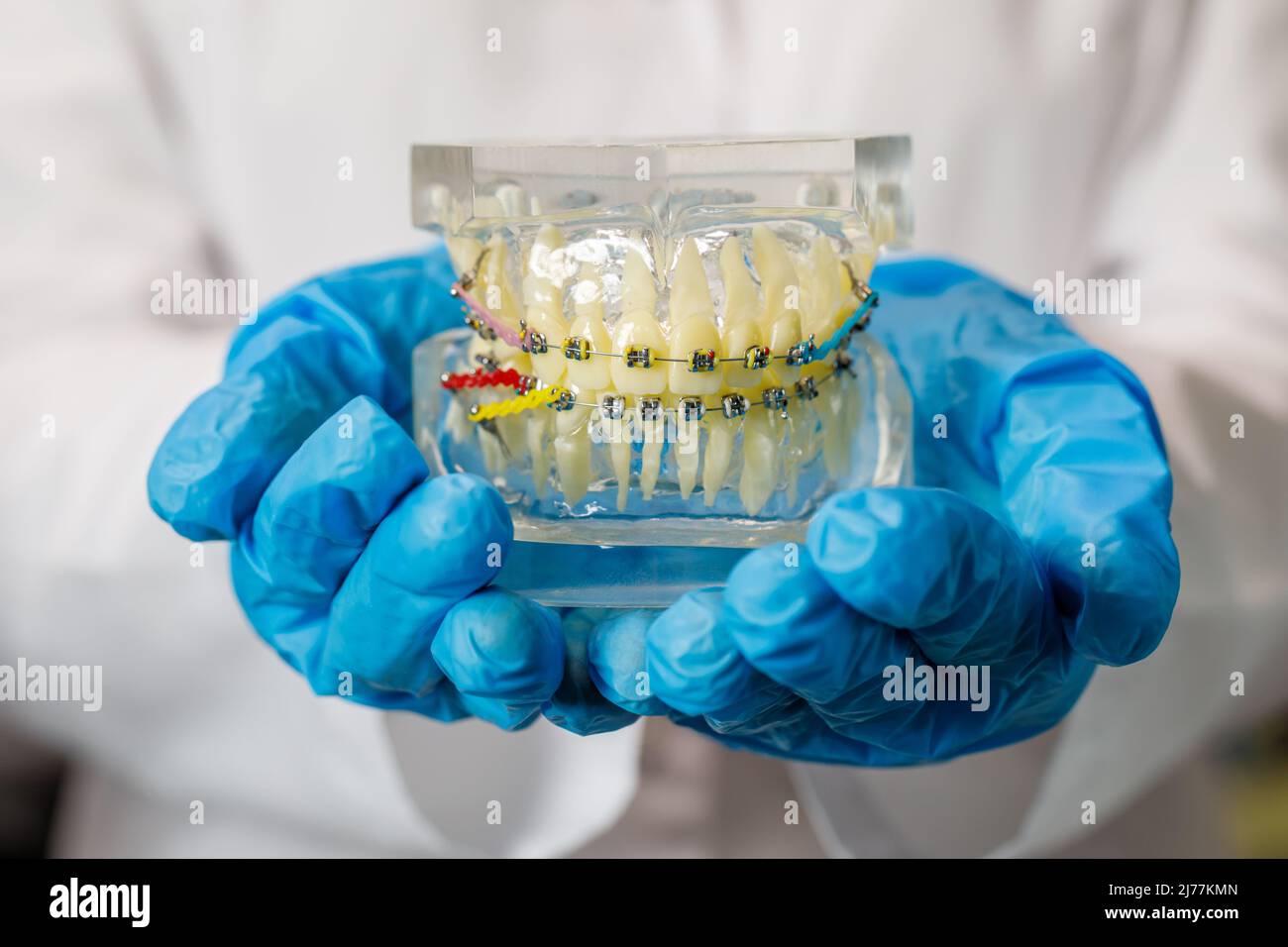 Stampo di denti umani close up. Modello di gesso dentale. Laboratorio protesico di gesso di gesso umano. Dentista cura dei denti imag Foto Stock