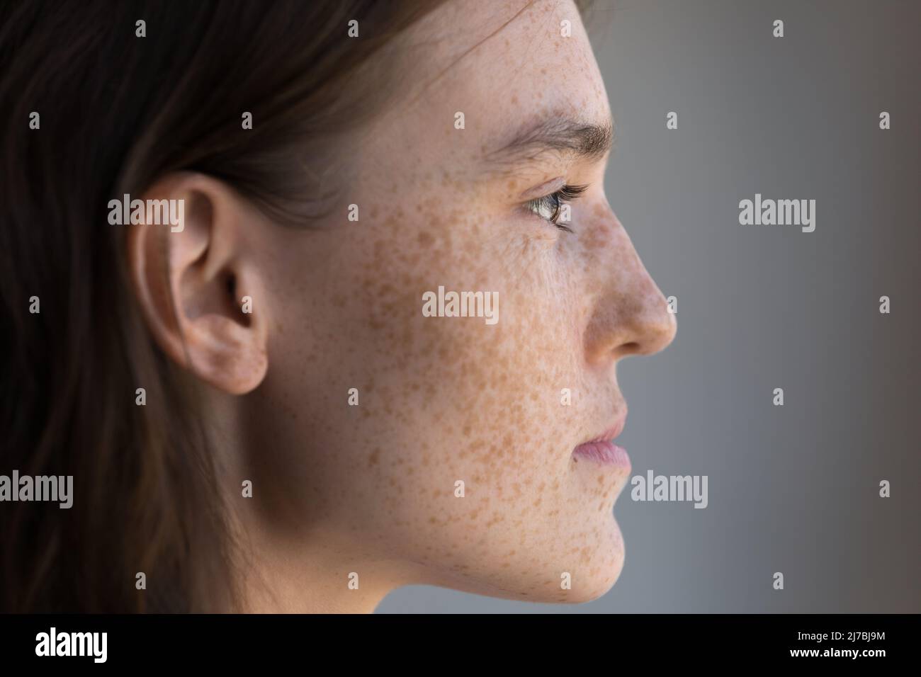 Il viso della ragazza frickled premuroso in primo piano Foto Stock