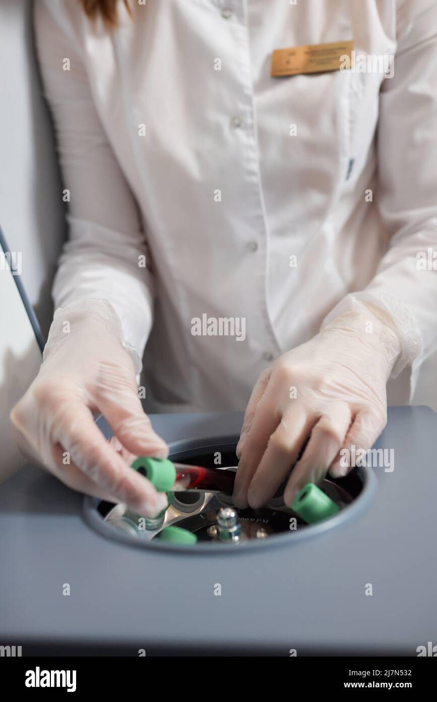Preparazione del plasma ricco di piastrine. Plasma in siringa. Centrifugare Foto Stock