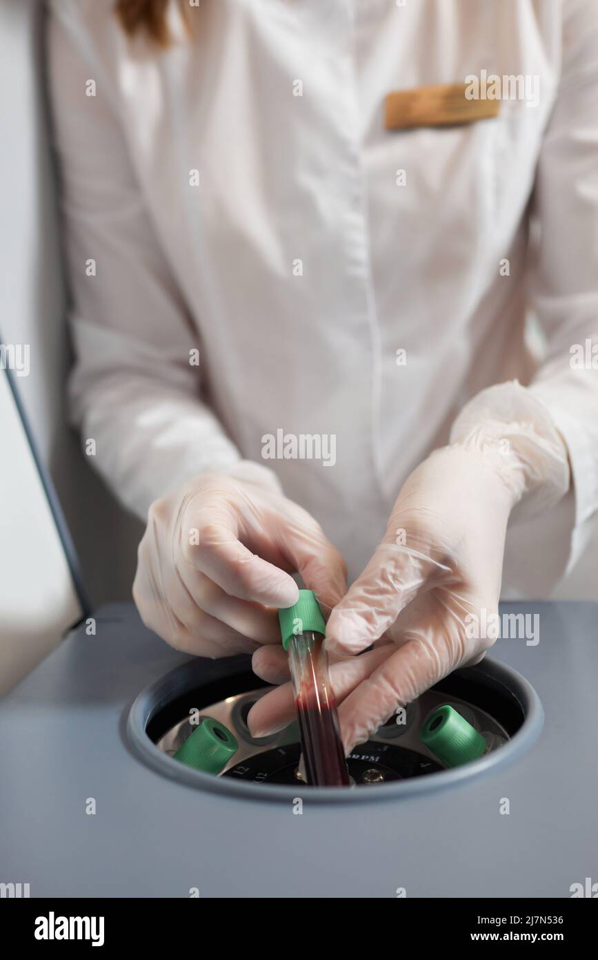 Preparazione del plasma ricco di piastrine. Plasma in siringa. Centrifugare Foto Stock