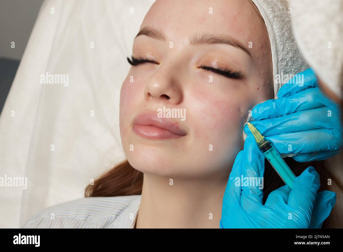 Siringa con plasma sanguigno di un paziente in una mano di un cosmetologo per un plasmolifting della pelle del viso di una donna. Plasma terapia, il ripristino delle cellule della pelle Foto Stock