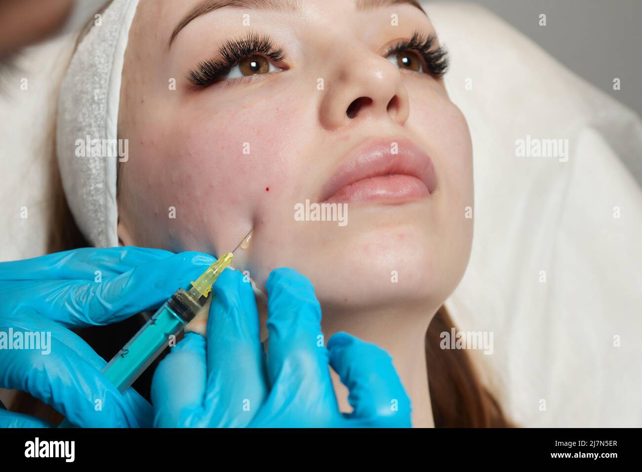 Siringa con plasma sanguigno di un paziente in una mano di un cosmetologo per un plasmolifting della pelle del viso di una donna. Plasma terapia, il ripristino delle cellule della pelle Foto Stock