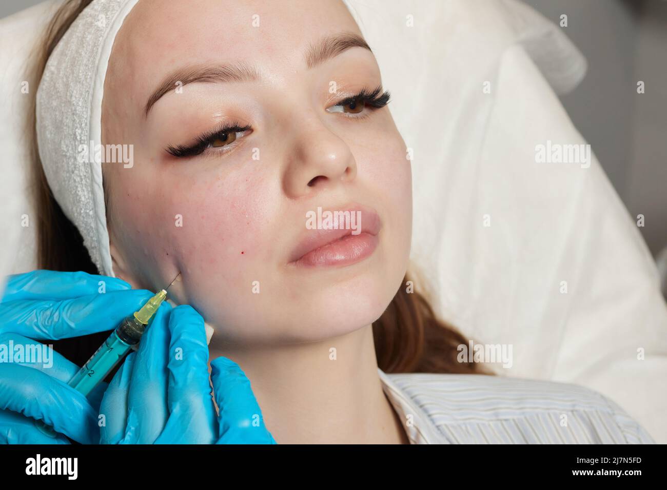 Siringa con plasma sanguigno di un paziente in una mano di un cosmetologo per un plasmolifting della pelle del viso di una donna. Plasma terapia, il ripristino delle cellule della pelle Foto Stock