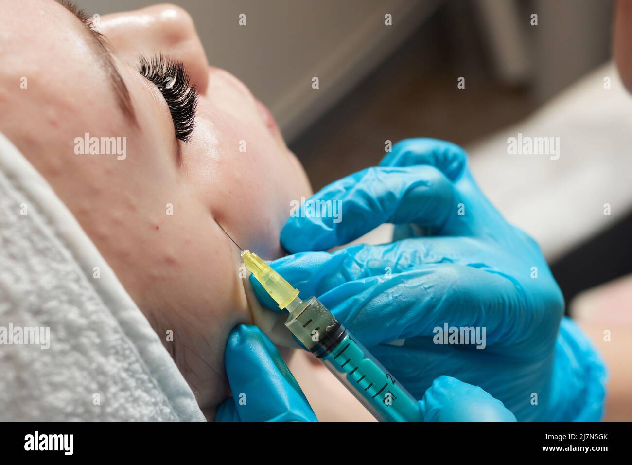 Siringa con plasma sanguigno di un paziente in una mano di un cosmetologo per un plasmolifting della pelle del viso di una donna. Plasma terapia, il ripristino delle cellule della pelle Foto Stock