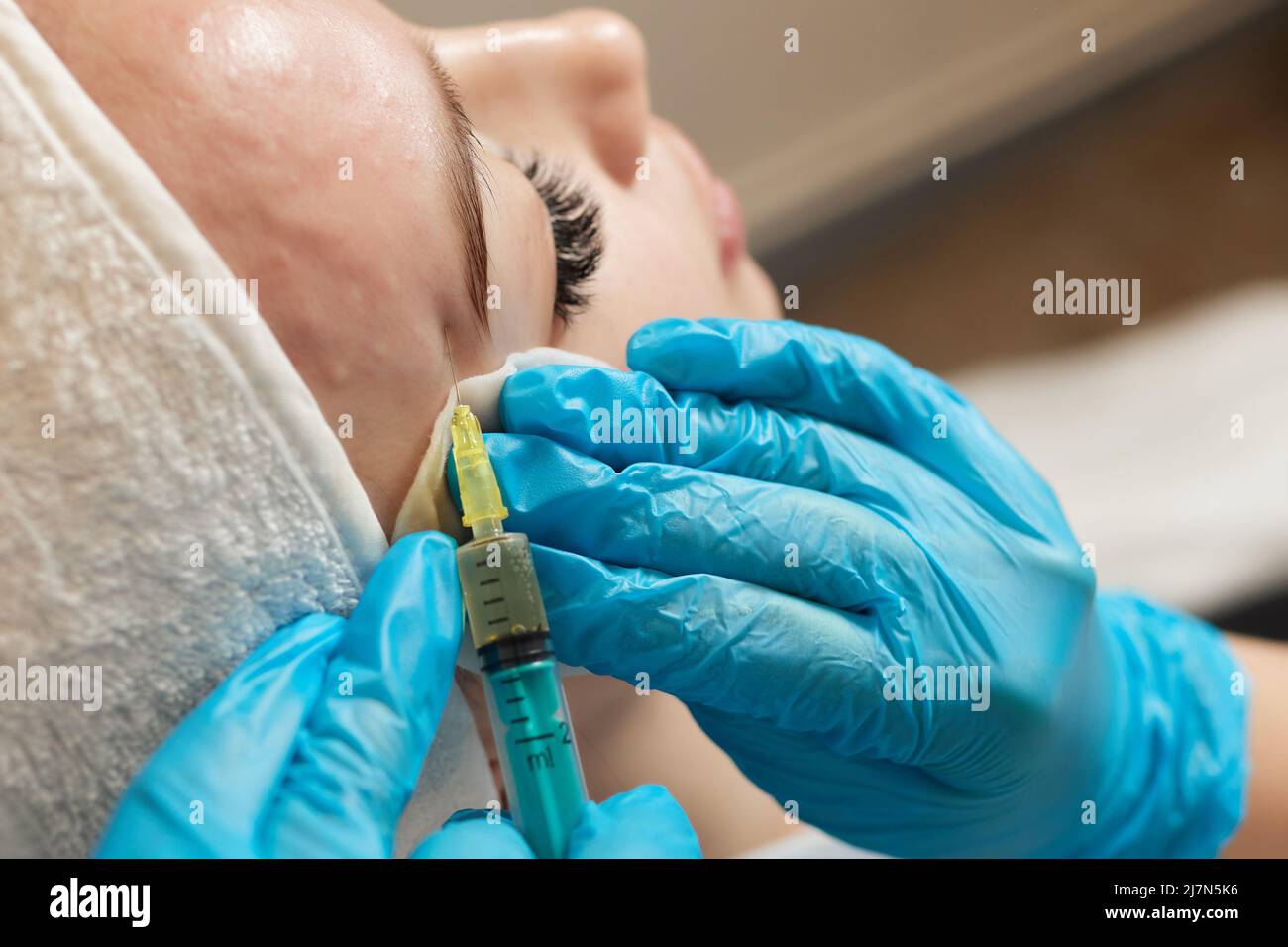 Siringa con plasma sanguigno di un paziente in una mano di un cosmetologo per un plasmolifting della pelle del viso di una donna. Plasma terapia, il ripristino delle cellule della pelle Foto Stock