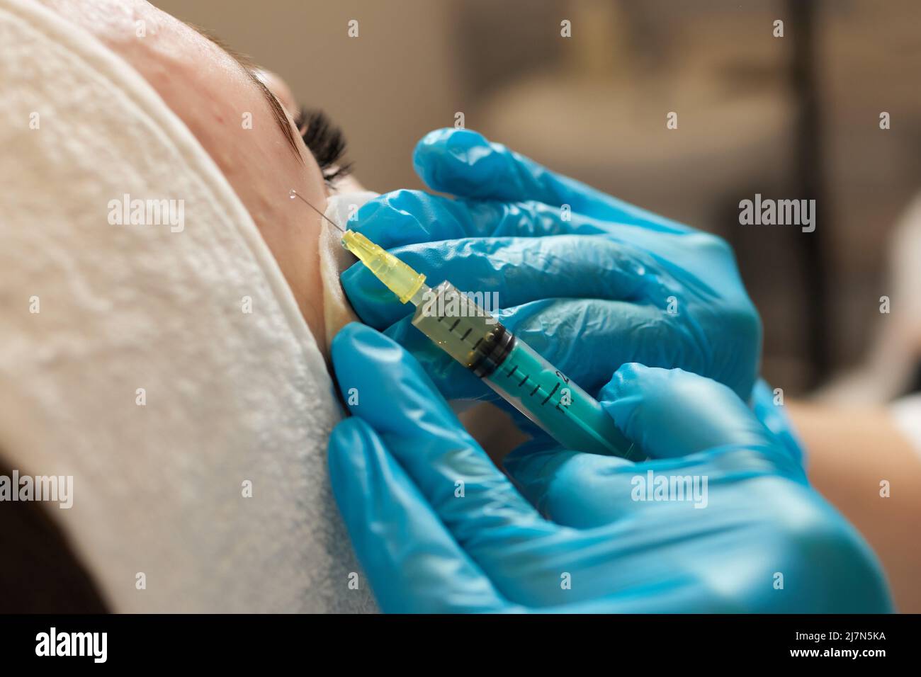 Siringa con plasma sanguigno di un paziente in una mano di un cosmetologo per un plasmolifting della pelle del viso di una donna. Plasma terapia, il ripristino delle cellule della pelle Foto Stock