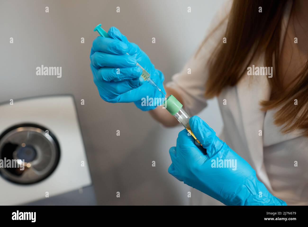 Preparazione del plasma ricco di piastrine. Plasma in siringa. Centrifugare Foto Stock