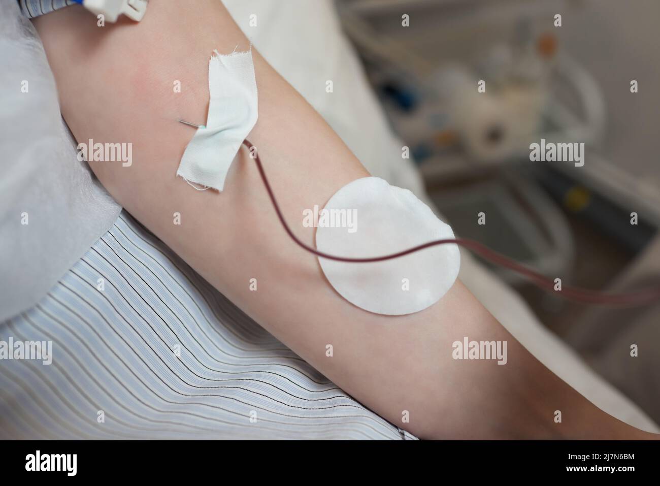 Giovane donna in trasfusione di sangue concetto mano Foto Stock