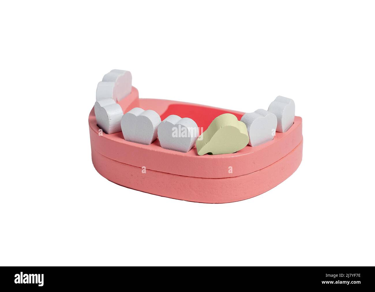 Dente malato in legno mandibola umana modello isolato su sfondo bianco. Carie, mal di denti, scarsa igiene orale, malattie dentarie, cattivo mangiare abitudini concetto. Giocattolo per bambini. Foto di alta qualità Foto Stock
