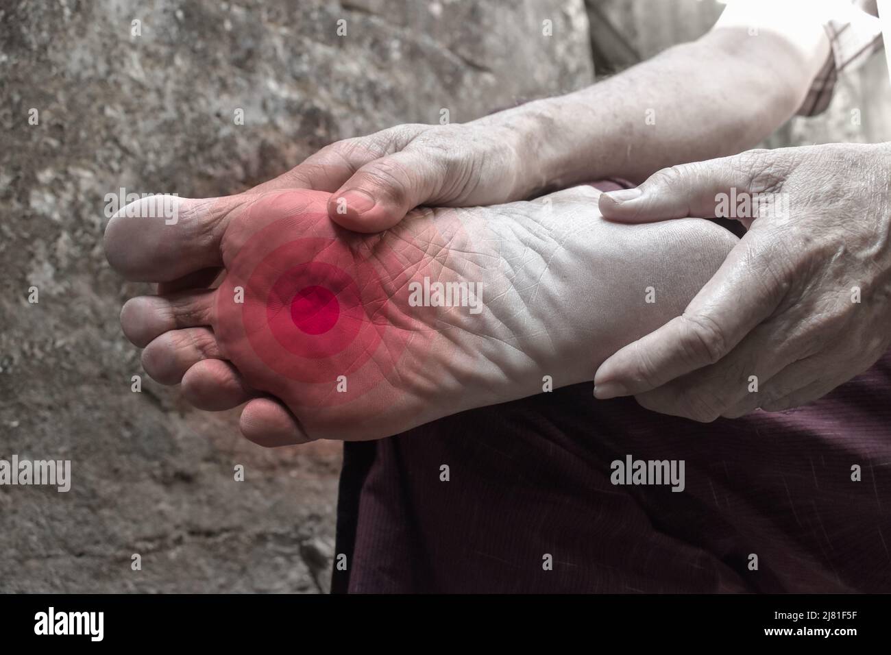 Sensazione di formicolio e bruciore ai piedi del vecchio asiatico con  diabete. Dolore al piede. Problemi di neuropatia sensoriale. Problemi ai  nervi del piede. Fascite plantare Foto stock - Alamy