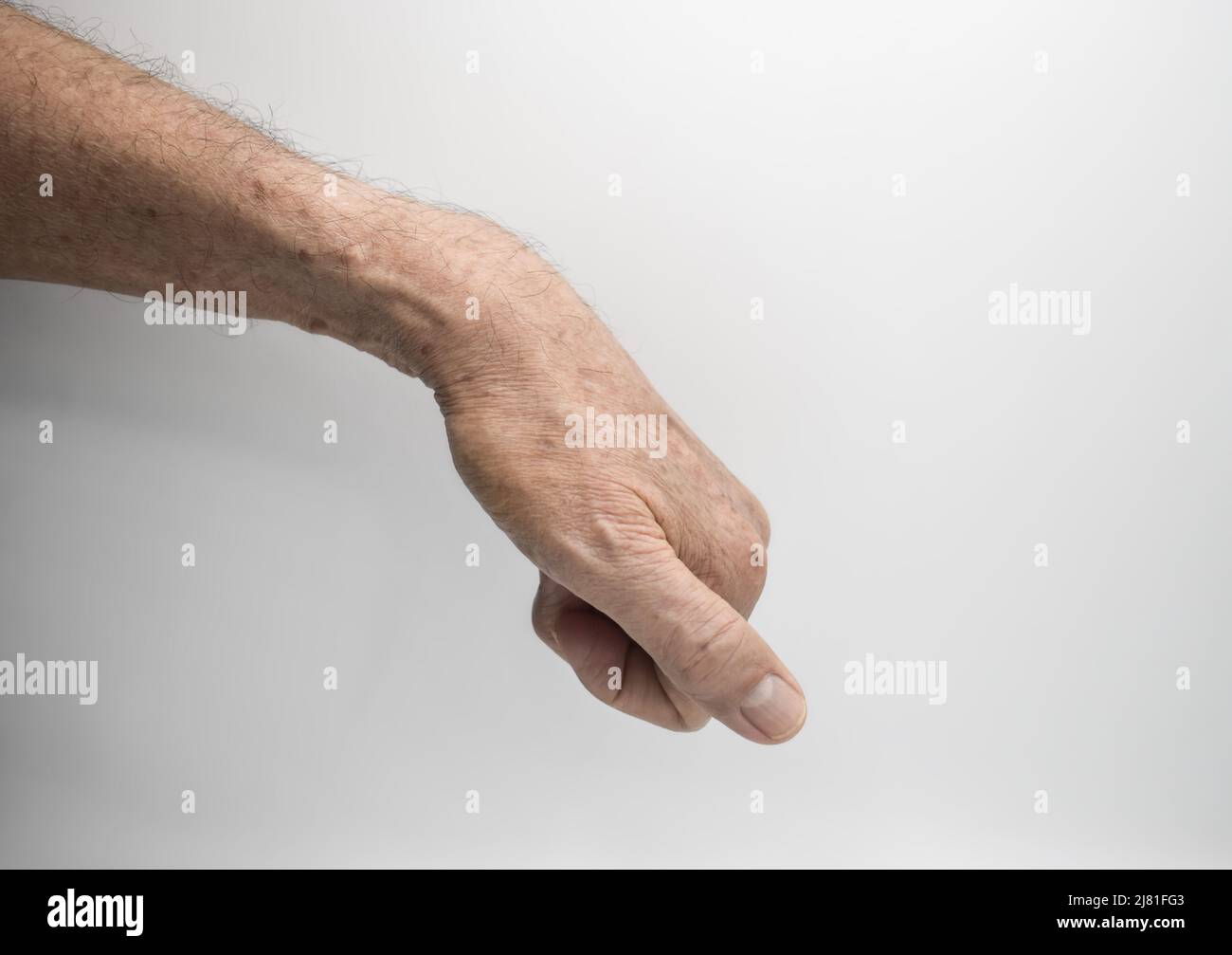 Rigidità muscolare della mano e flessione delle dita dell'anziano asiatico. Foto Stock