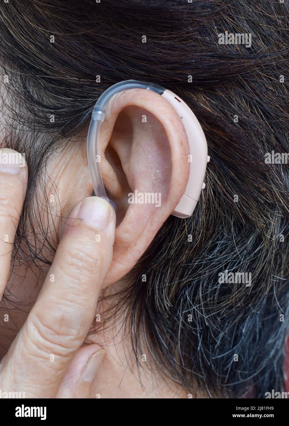 Apparecchio acustico elettronico nell'orecchio di una vecchia donna asiatica con totale sordità. Foto Stock