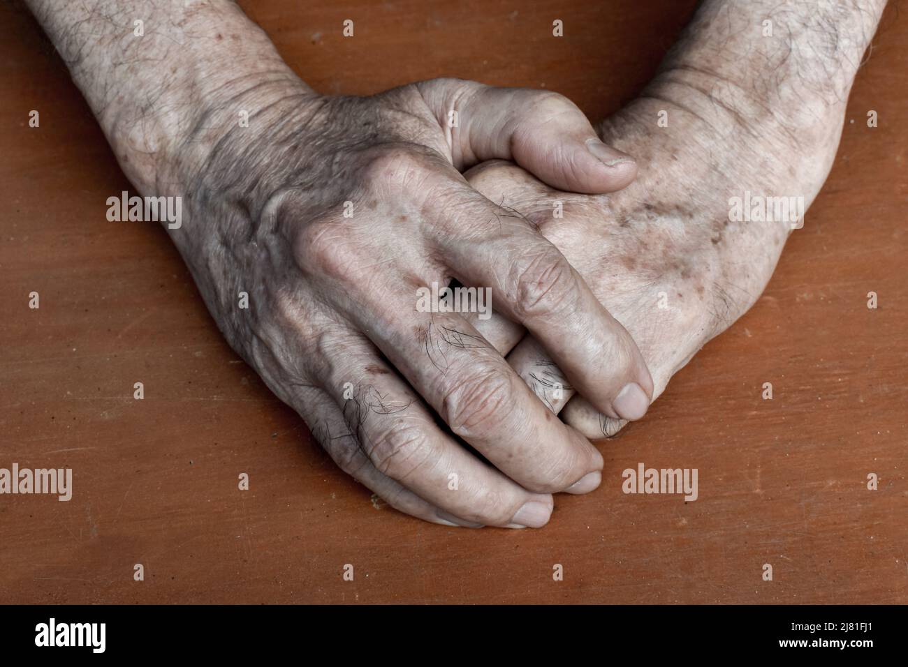 Mano dell'anziano del sud-est asiatico. Concetto di artrite reumatoide, osteoartrite, o dolore articolare. Foto Stock