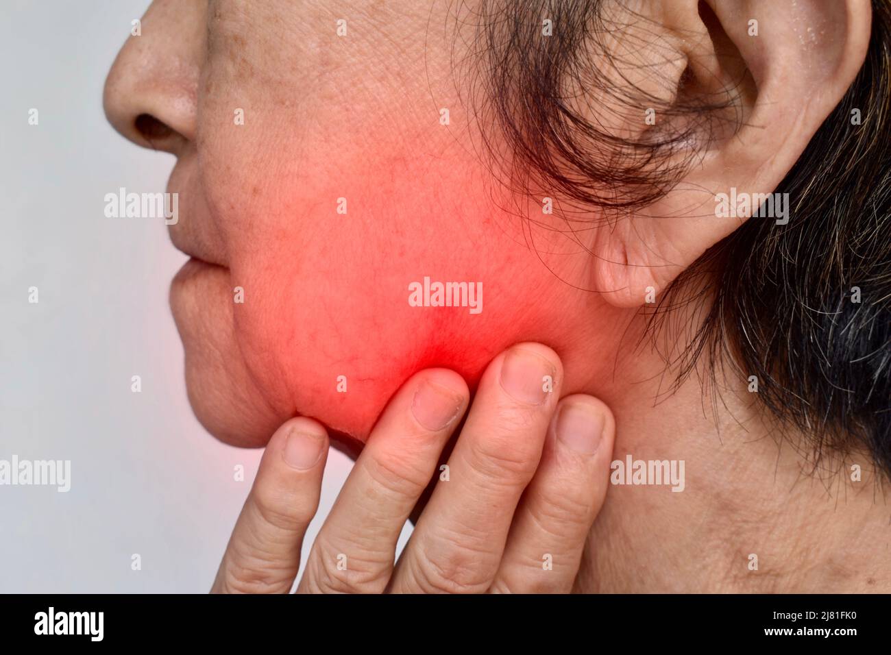 Infiammazione alla guancia della paziente femminile asiatica. Sente il mal di denti di saggezza e la mascella tenero. Foto Stock