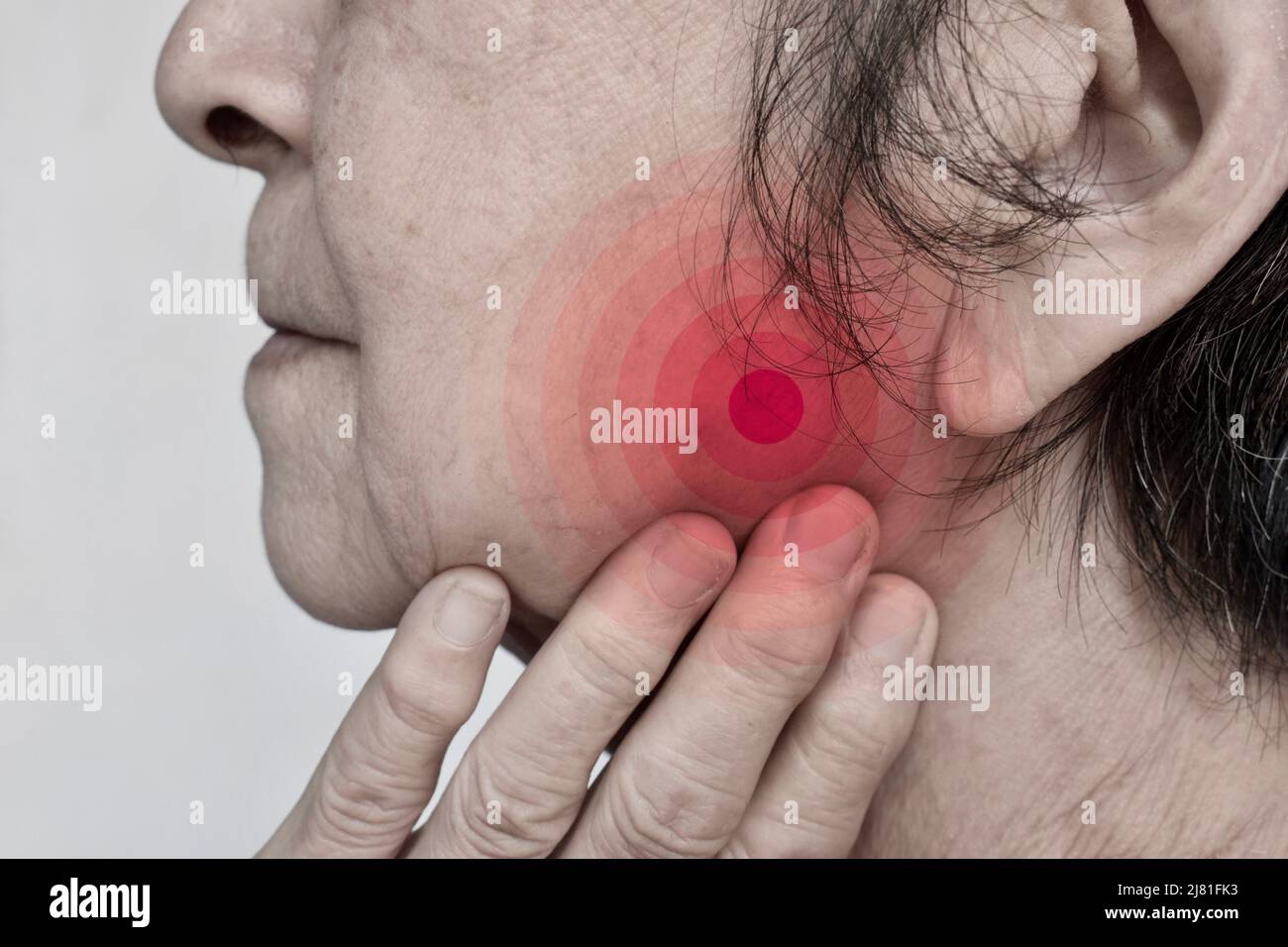Infiammazione alla guancia della paziente femminile asiatica. Sente il mal di denti di saggezza e la mascella tenero. Foto Stock