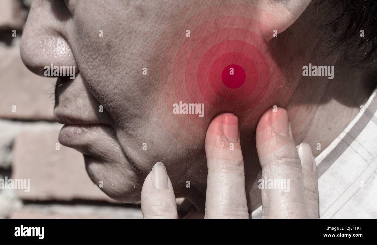 Infiammazione alla guancia di un paziente maschile asiatico. Sente il mal di denti di saggezza e la mascella tenera. Foto Stock