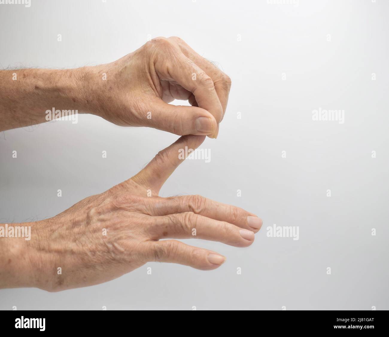 Rafforzare l'esercizio per la salute delle dita di pazienti maschi anziani asiatici con spasmo muscolare. Foto Stock
