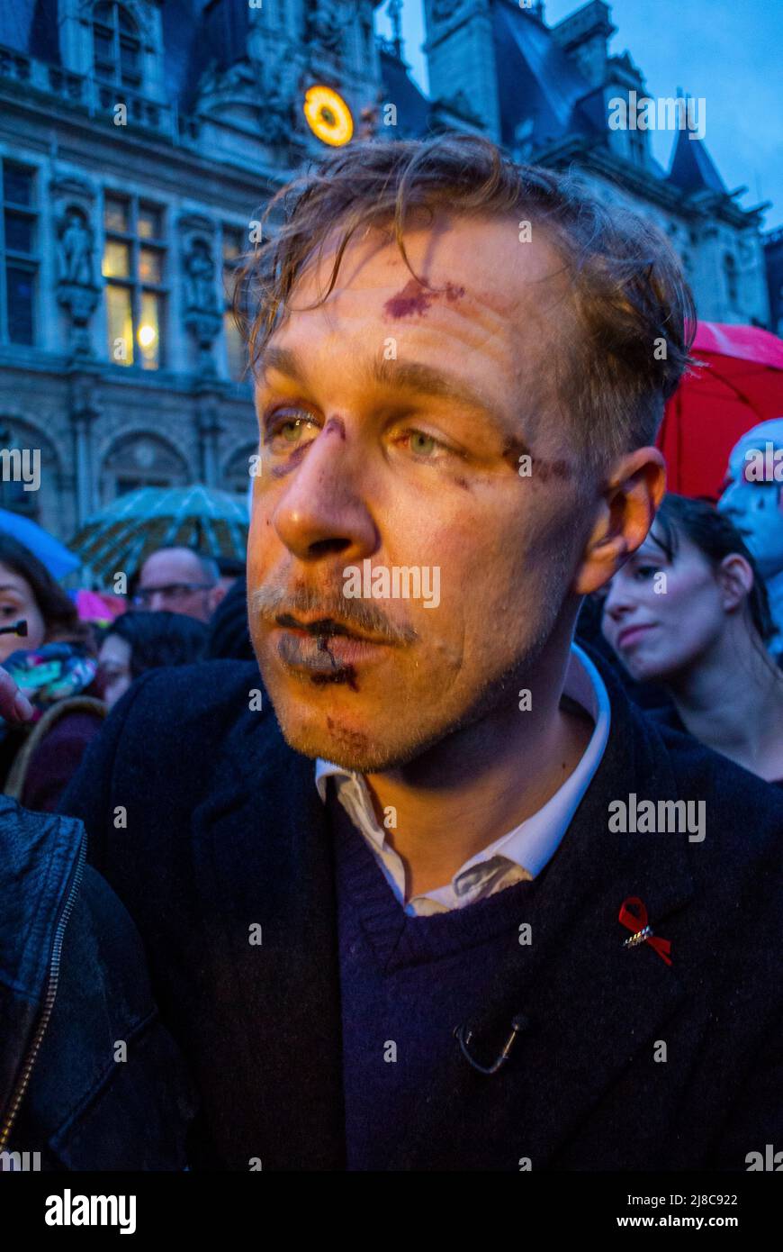 Parigi, Francia, Ritratto vittima di un attacco omofobico a Paris Street, Wilfred de Brujn, violenza contro gli omosessuali Foto Stock