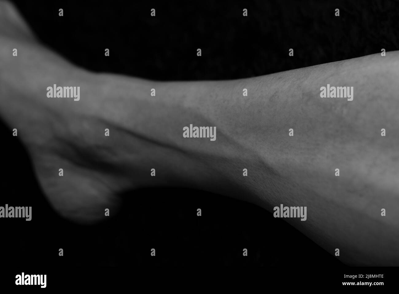 Vene sporgenti nel corpo umano, forme del corpo umano, medicina, esperimenti del corpo umano. Vene di sangue del corpo umano. Vene delle gambe umane. Foto Stock