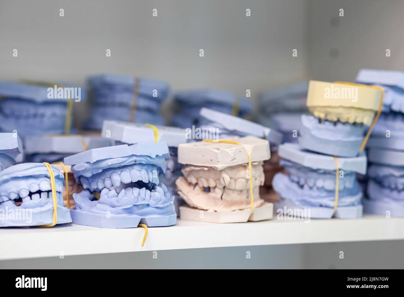 Modello Denti Ortodontico Con Staffe E Legature Per Studio E Insegnamento