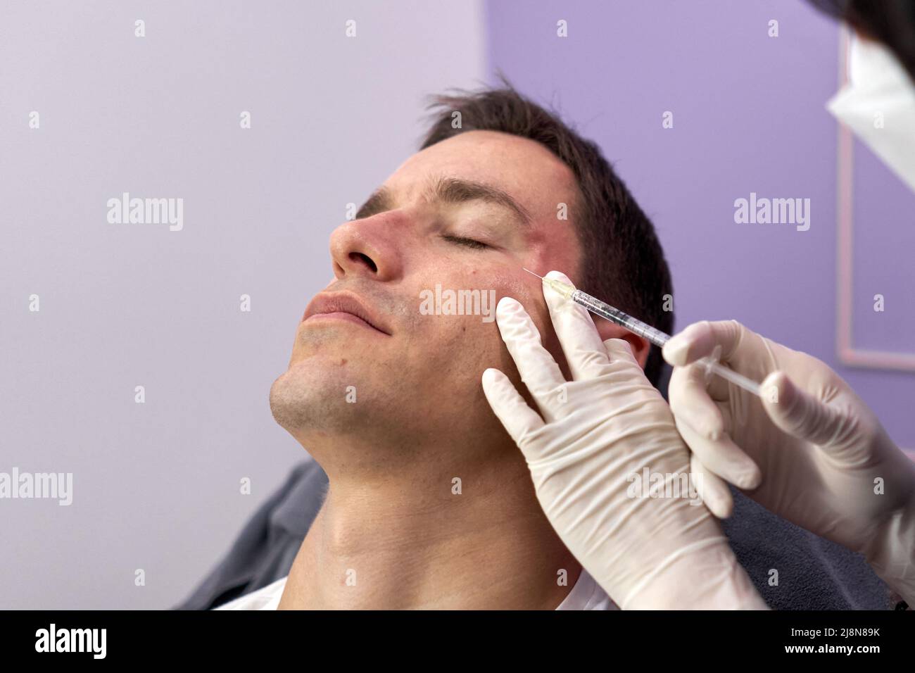 Il paziente si è rilassato durante un trattamento di ringiovanimento con iniezione di botox Foto Stock