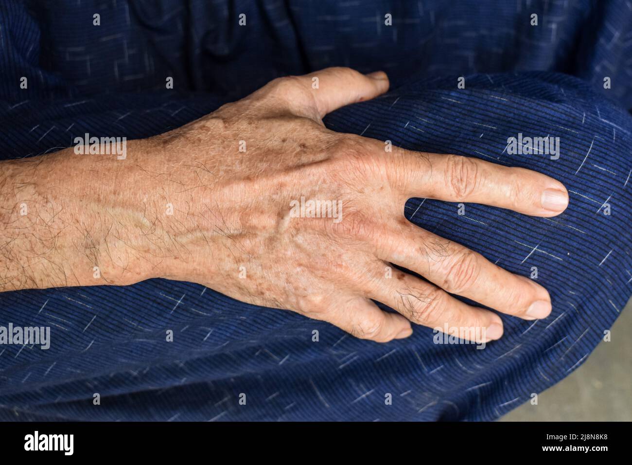 Mano dell'anziano del sud-est asiatico. Concetto di artrite reumatoide, osteoartrite, o dolore articolare. Foto Stock
