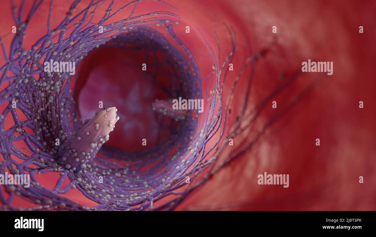 3D illustrazione di una cellula di cancro. La diffusione della malattia nel corpo. Concetto medico. Foto Stock