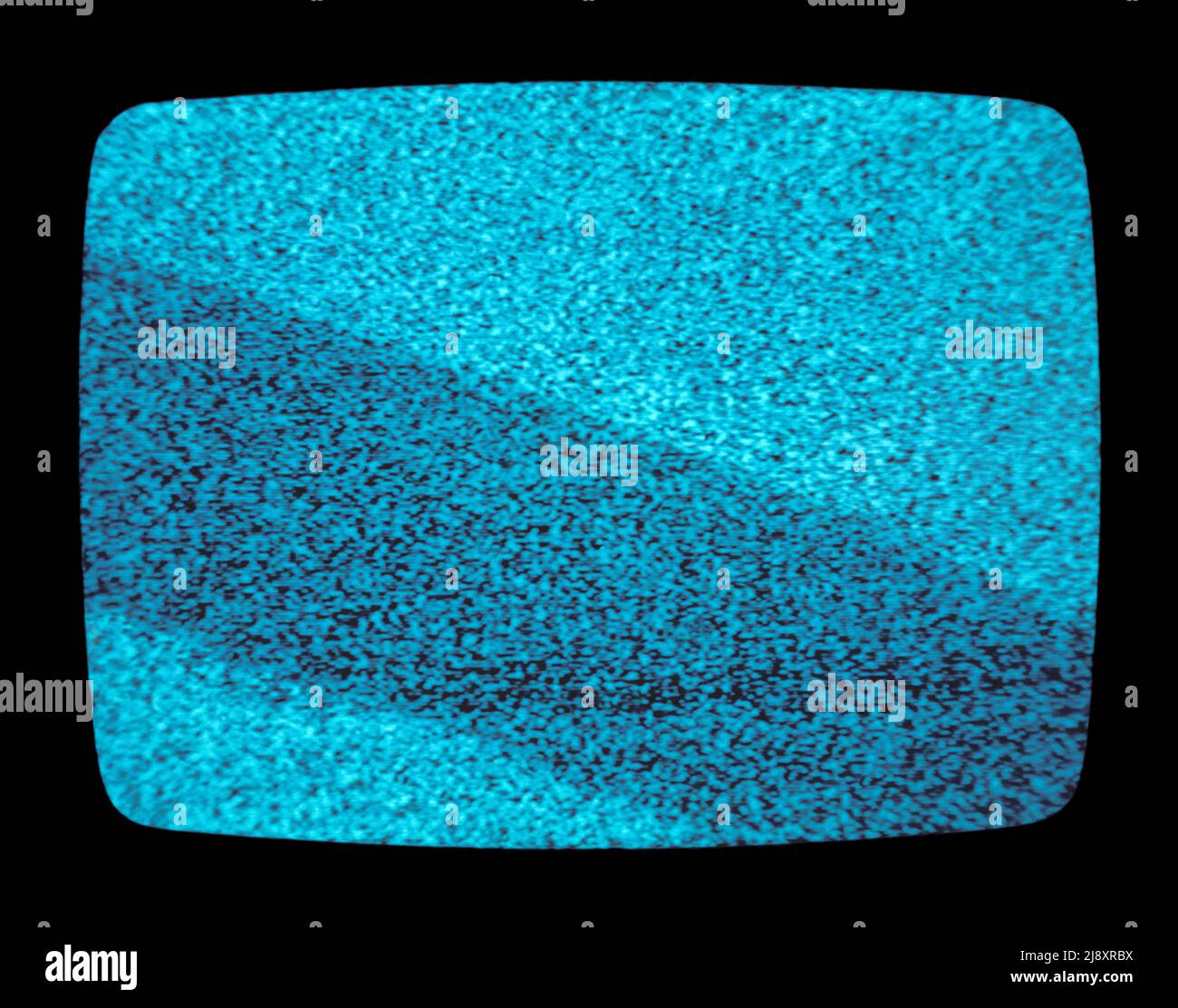 Statico sullo schermo di un televisore CRT Foto Stock