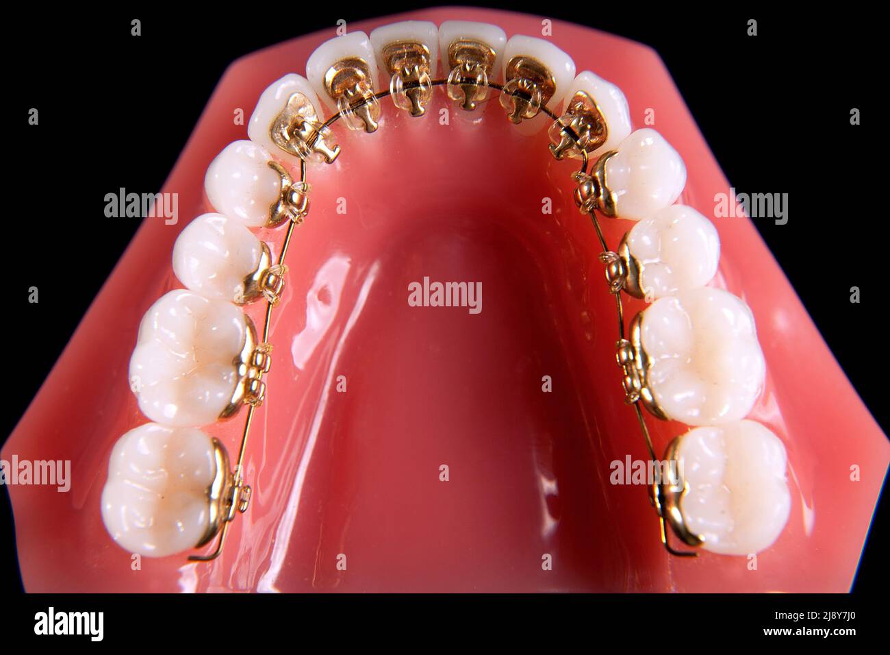 Straighten teeth immagini e fotografie stock ad alta risoluzione - Alamy
