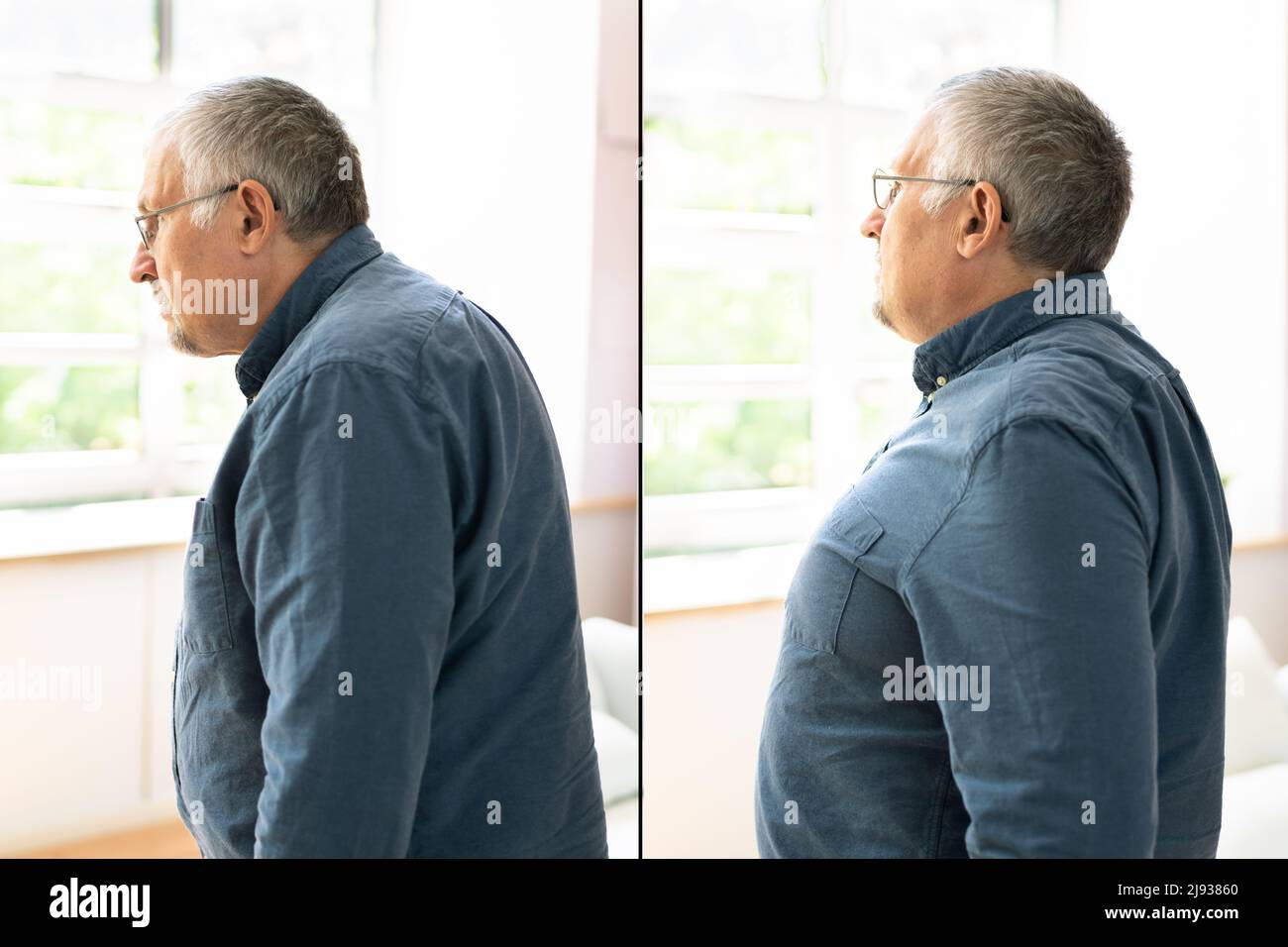 Uomo con lordosi e curvatura normale contro sfondo grigio Foto Stock