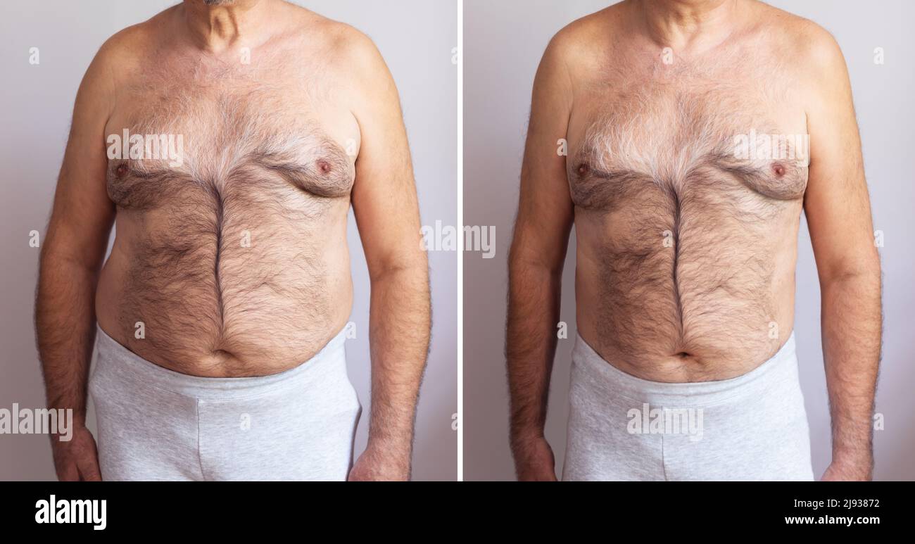 Ritratto di un uomo maturo prima e dopo la perdita di peso su sfondo bianco. Forma del corpo è stata alterata durante il ritocco Foto Stock