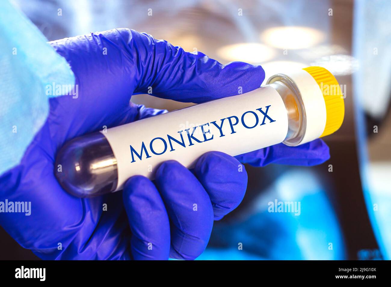 Nuovo campione infettivo della malattia del virus Monkeypox in provetta da laboratorio nella mano dello scienziato in guanto medico blu su sfondo chiaro. Foto Stock