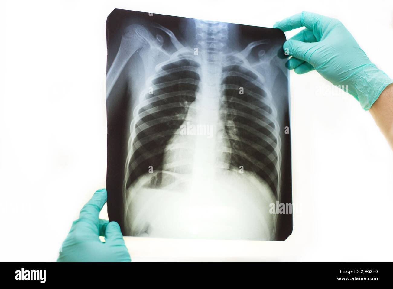 Mano dell'uomo che tiene una radiografia dei polmoni isolata su uno sfondo bianco. Medico che indossa maschera e guanti che guardano la radiografia del torace Foto Stock