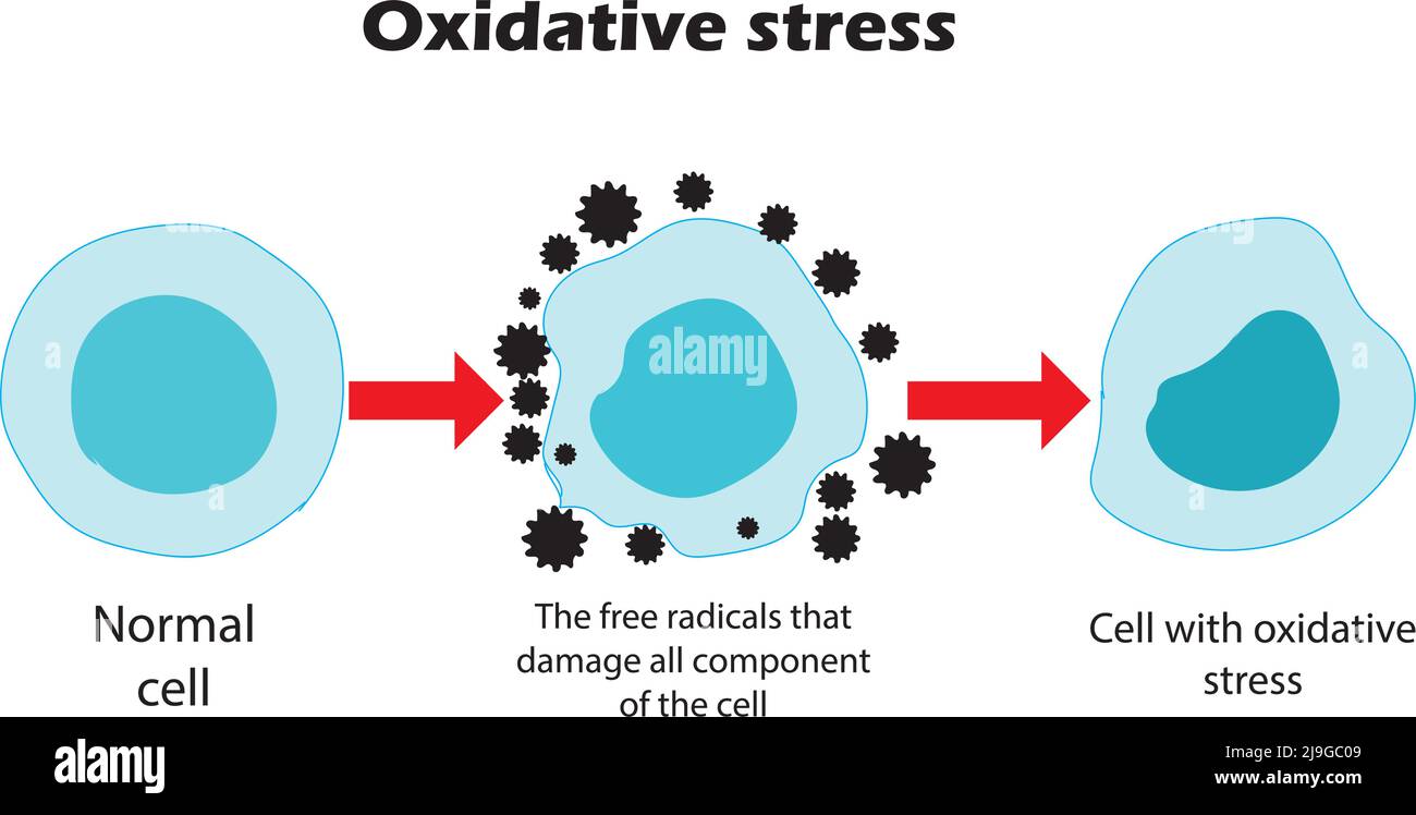 Stress ossidativo. Dalle cellule normali, allo stress ossidativo e ai radicali liberi aggressivi, alla morte cellulare. Contenuto educativo e di studio per studenti di biologia. Illustrazione Vettoriale